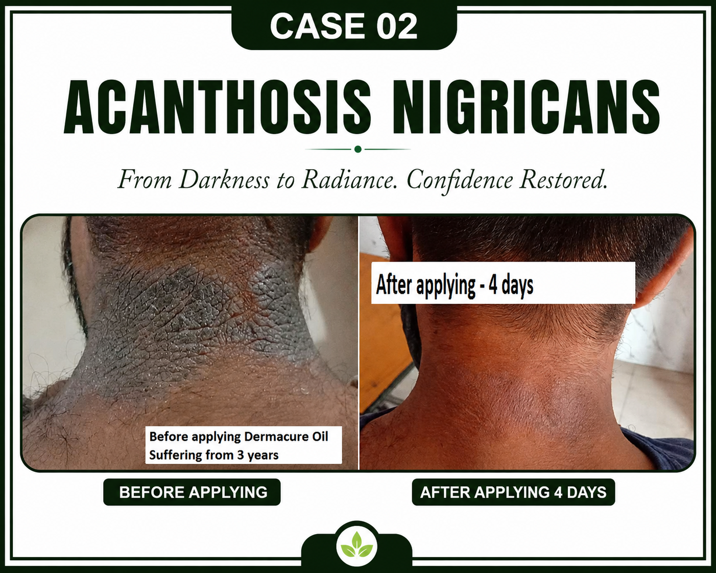Case 2