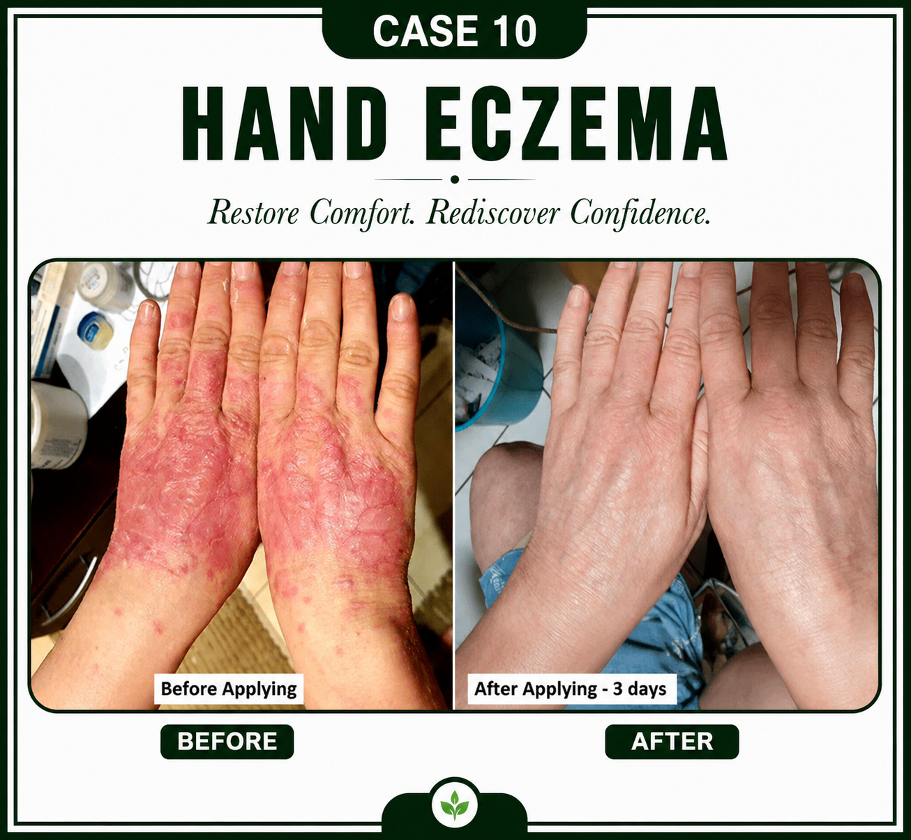 Case 10