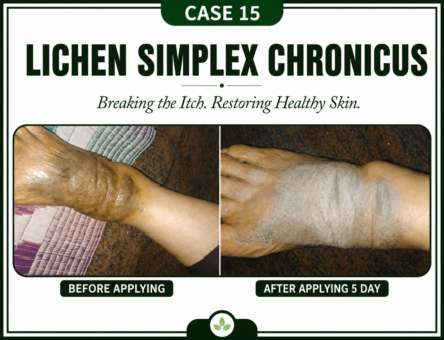 Case 15