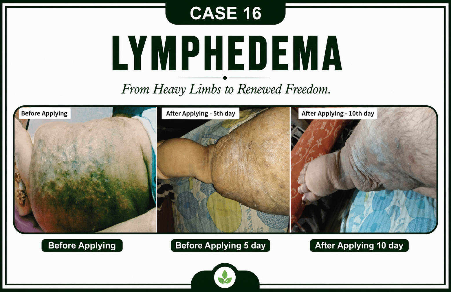 Case 16